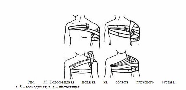 Повязка на область плеча