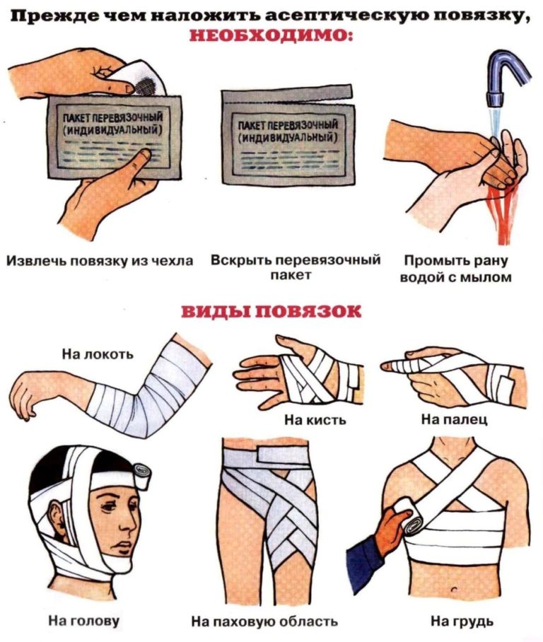 Первая помощь при ранах и кровотечениях презентация